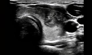 运城市第一医院 运城市第一医院